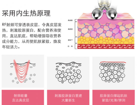 RF射频又称为高周波，其通过发射无线电波到皮下组织产生热能