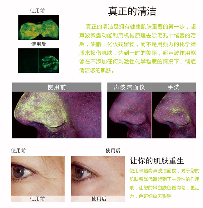 卡酷尚KD-172洁面仪清理前后实拍